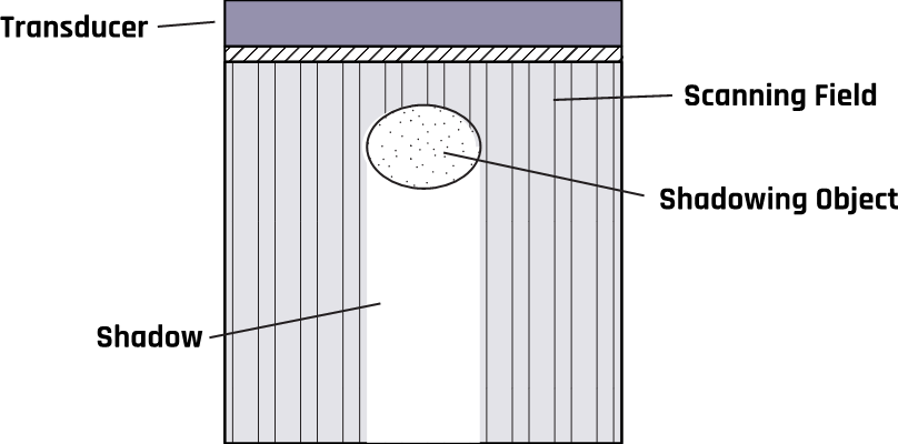 One of the assumptions of ultrasound imaging is that the beam travels in a straight line.