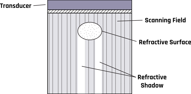 Schematic of the formation of a ghost artifact.