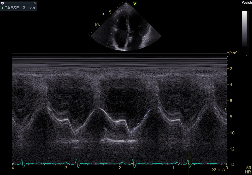 Typical example of the M-mode showing a four-chamber view of the heart.