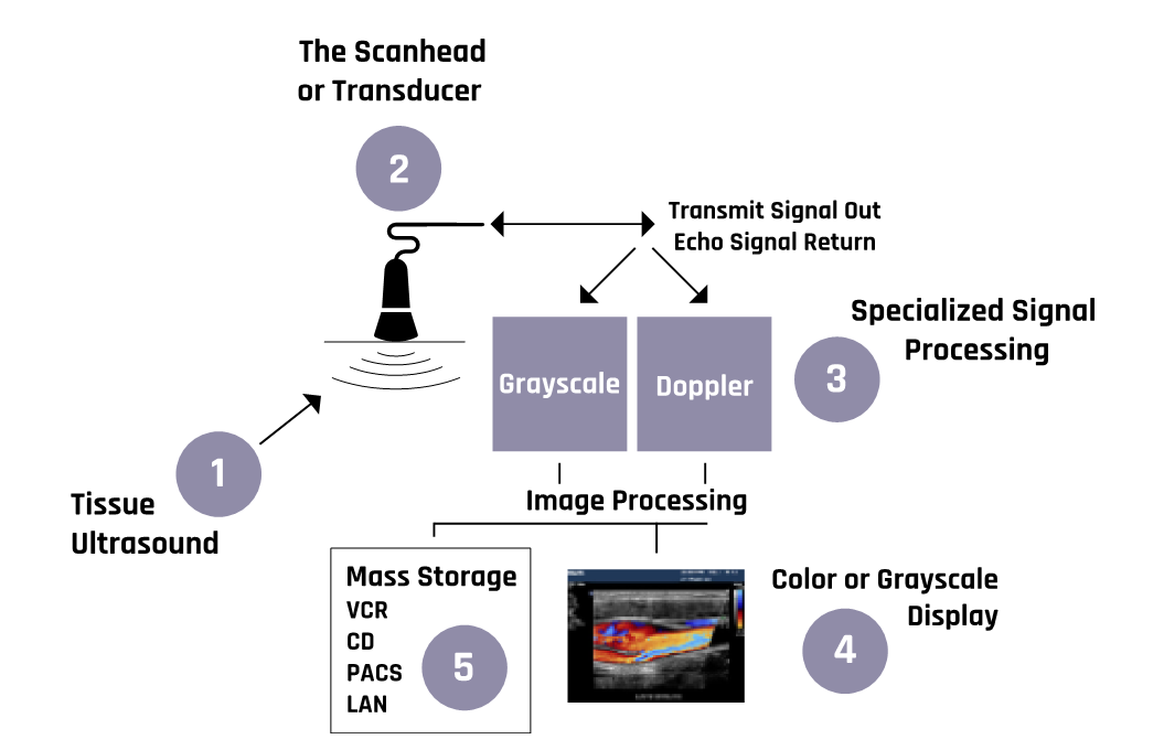 Schematic of the mode of operation of ultrasound machines.