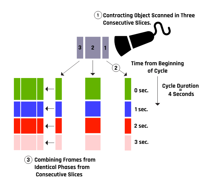 A schematic of the formation of a 4D ultrasound image.