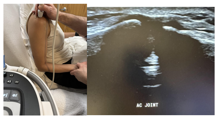 Examination of the acromioclavicular joint in the sagittal plane.