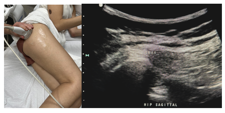 Side-by-side pictures of the transducer position and image of the gluteus maximus (GMAX) in the sagittal plane.