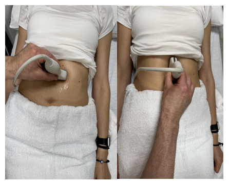 Transducer position in the transverse and sagittal planes to evaluate the abdominal aorta.