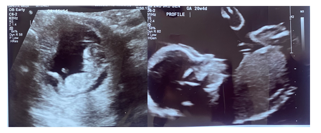 Fetal development from the 9th week to the 20th week.